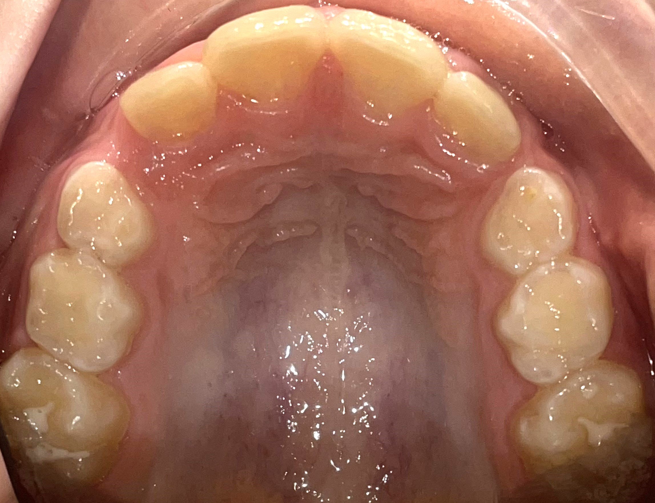 Dental and Orthodontic Concerns — Spot On Orofacial Myology Clinic
